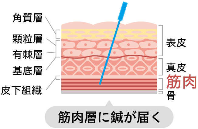 鍼灸イメージ